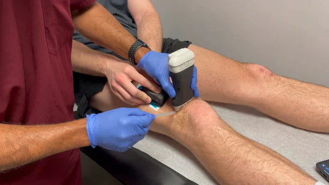 Close-up of Buzzy Pro reusable pain relief tool for blood tests